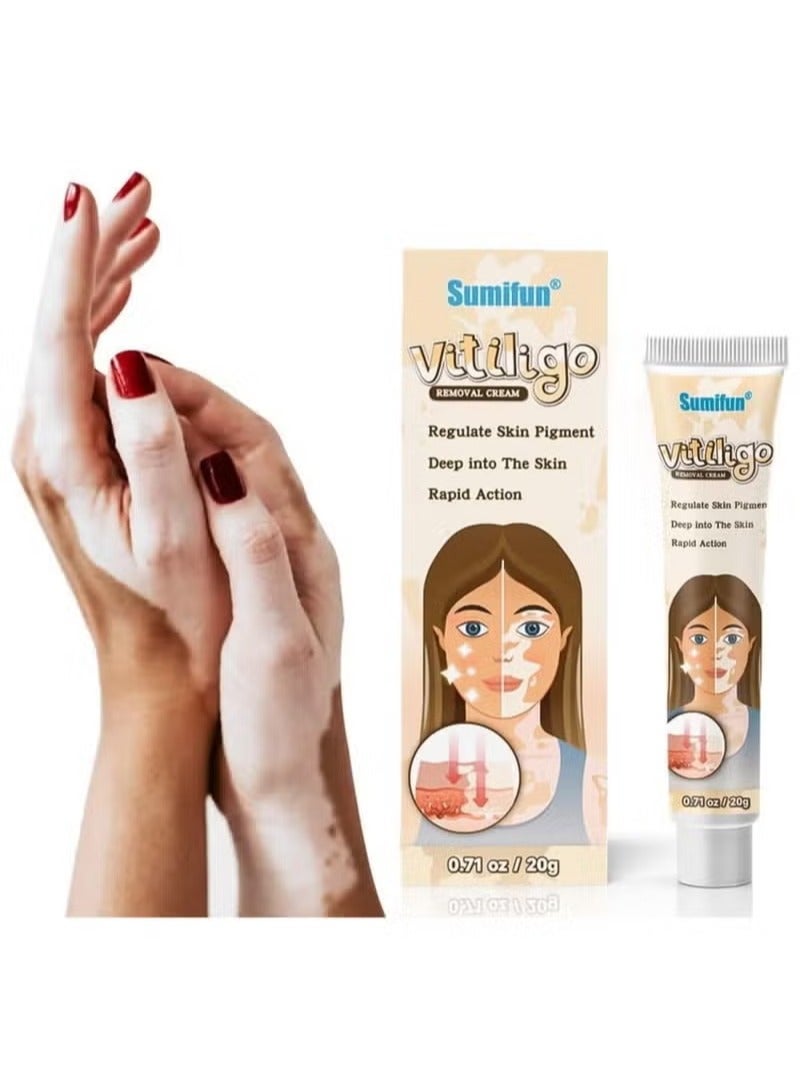 Sumifun Vitiligo Skin Care Cream, Reduces White Spot, Improve Skin Pigmentation - Image 2